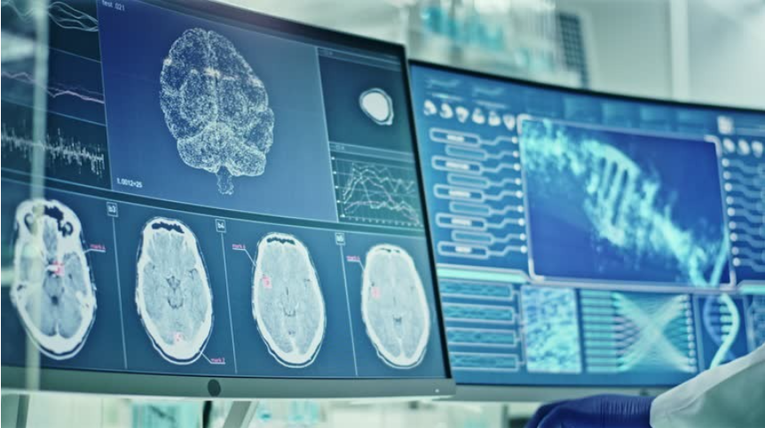 Fokussierter Ultraschall